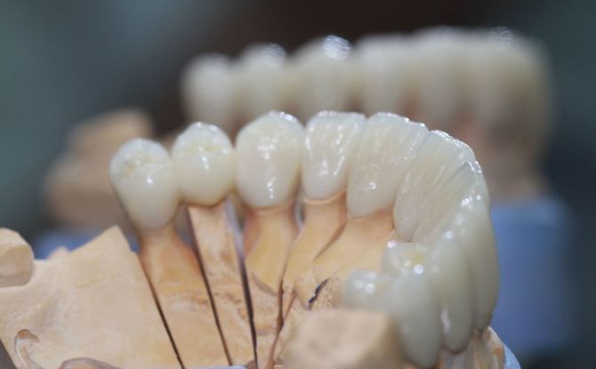 Couronnes en zirconium: avantages et inconvénients, différences, indications d'installation