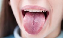 Diagnostic des maladies humaines par langue