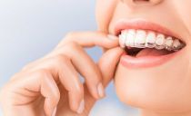 Comment aligner les dents avant et à mâcher sans croisillons chez les enfants et les adultes