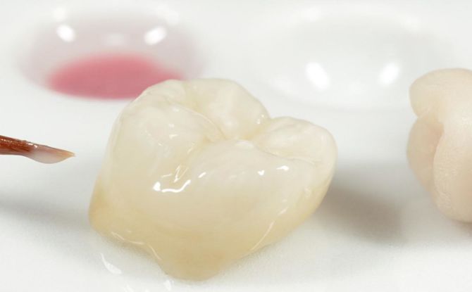 Couronnes sur les dents: types, avantages, inconvénients et procédure d'installation