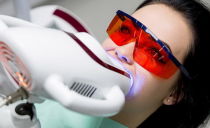 Blanchiment des dents avec le système Zoom 3: de quoi s'agit-il, blanchiment à la maison, vraies photos avant et après