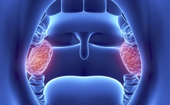 Glandes et amygdales dans la gorge: localisation, fonctions, causes de l'inflammation et méthodes de traitement