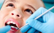 Pulpite d'une dent de bébé chez un enfant - symptômes, étapes du traitement, prévention