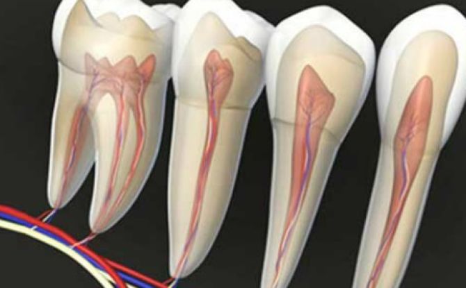 Inflammation du nerf dentaire: symptômes, traitement, gestion de la douleur à domicile