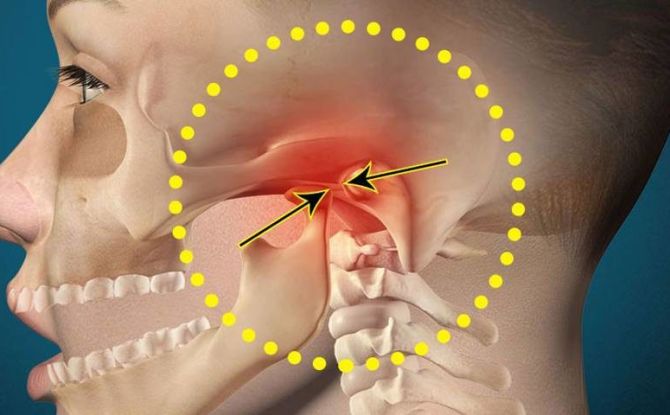 Pourquoi la mâchoire près de l'oreille fait-elle mal d'un ou deux côtés, options de traitement