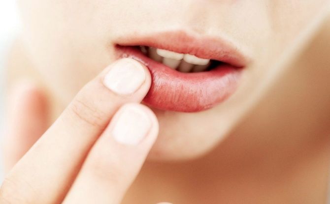 Onguents, crèmes et gels pour les boutons de fièvre sur les lèvres: une liste de médicaments efficaces pour les boutons de fièvre