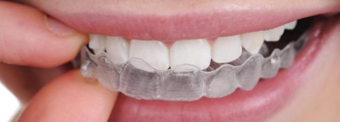 Protège-dents