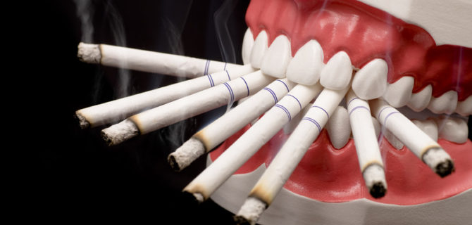 Tabagisme après extraction dentaire