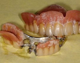 Prothèse non hygiénique
