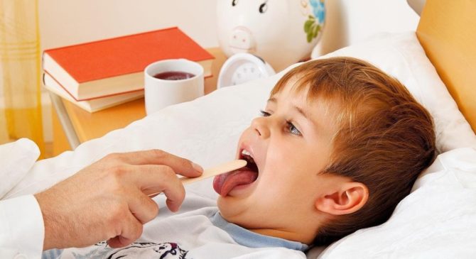 Enfant avec stomatite