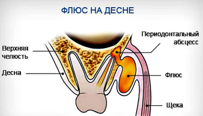Modèle de flux gingival