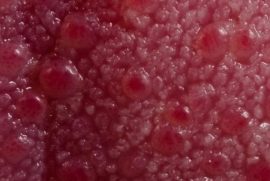 Une section de la langue avec des taches de sang rouge au microscope