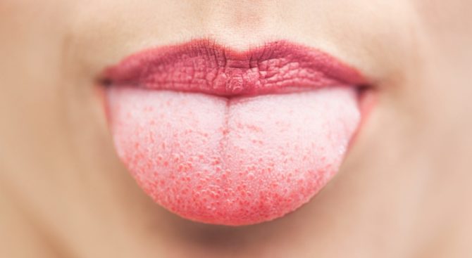 Langue avec boutons rouges